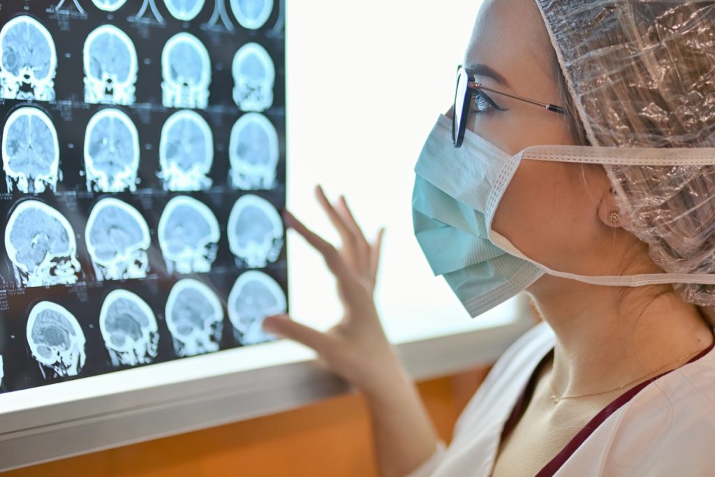 Une médecin examine une image IRM